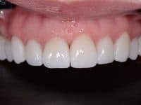 CARILLAS DE CERÁMICA