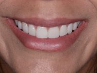 CARILLAS CERÁMICA E INCRUSTACIONES